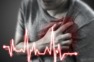 Cardiac, Heart Attack, Myocardial Infrarction